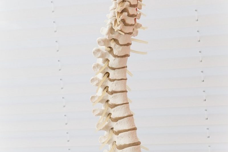 What is a Spinal Subluxation?